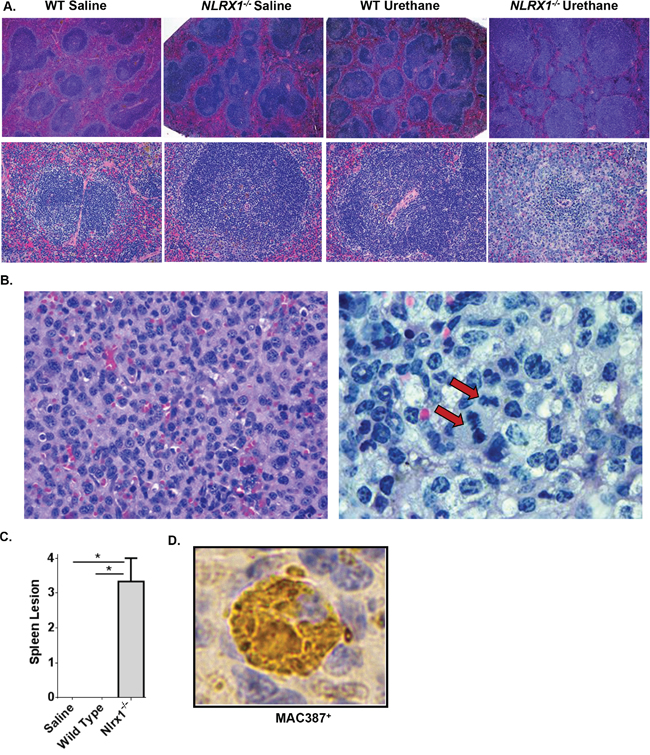 NLRX1 Attenuates the Development and Progression of Histiocytic Sarcoma.