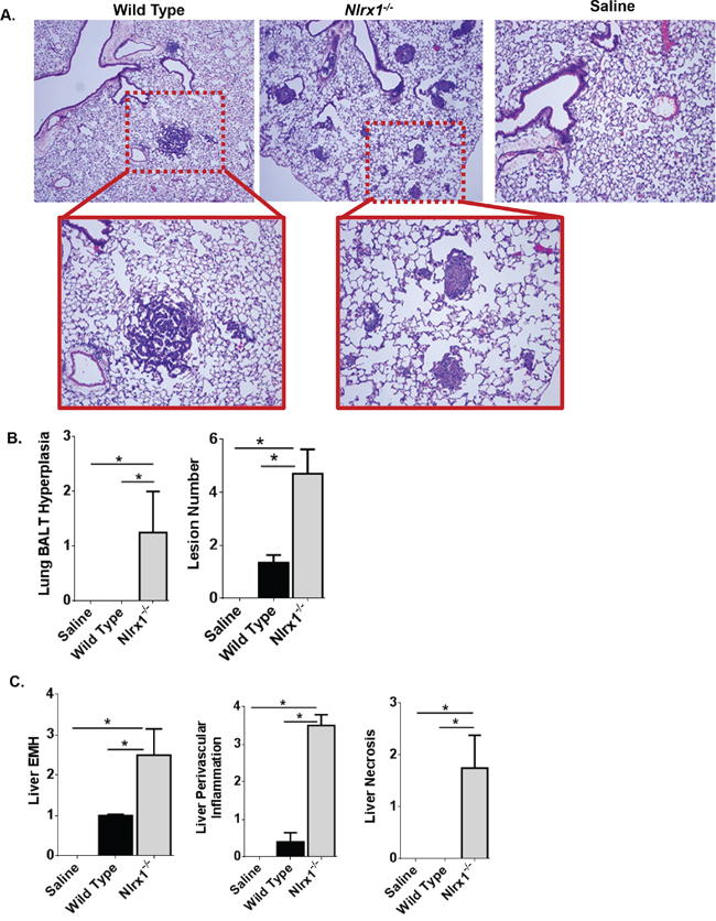 NLRX1 Attenuates Urethane Induced Lesions in the Lung and Liver.