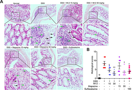 MALT1 inhibitors treatment prevented DSS-induced colon damage in mice.