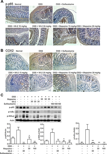 MALT1 inhibitors decreased activations of NF-&#x03BA;B signaling pathways in colon tissues from DSS-colitis mice.
