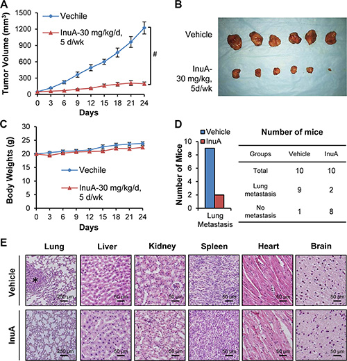 In vivo efficacy of InuA in nude mice bearing MDA-MB-231 orthotopic tumors.