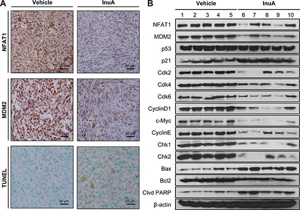 In vivo effects of InuA on NFAT1-MDM2 pathway and on the expression of proteins related to cell cycle progression, apoptosis, and DNA damage response.