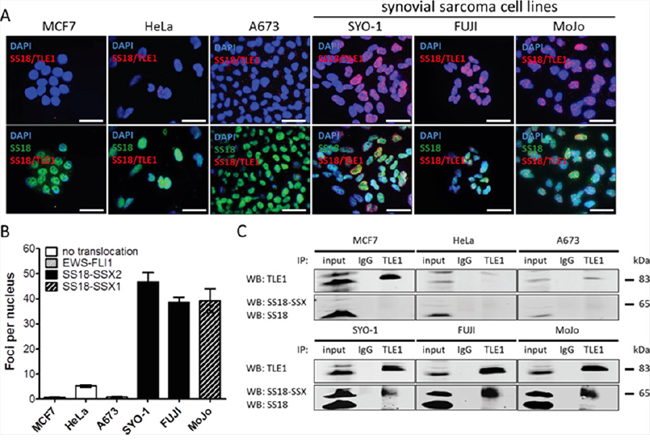 The proximity ligation assay demonstrates SS18-SSX/TLE1 co-localization selectively in synovial sarcoma cell lines.