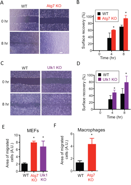 Involvement of Atg7 and Ulk1 in cell migration.