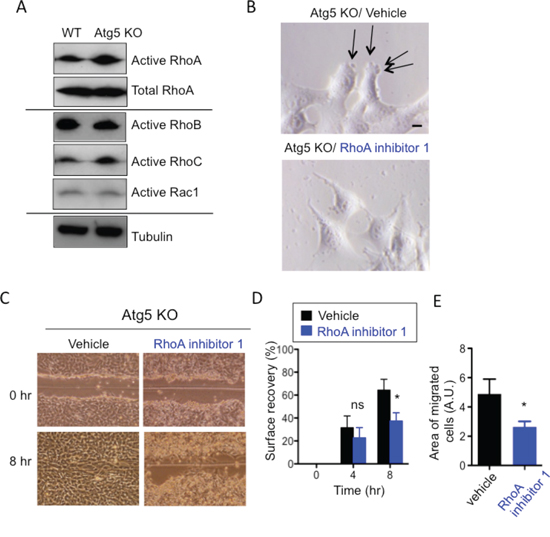 Involvement of RhoA in the amoeba-like migration of Atg5 KO MEFs.