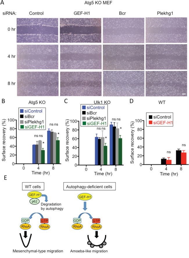 Involvement of GEF-H1 in the migration of Atg5 KO and Ulk1 KO MEFs, but not of WT MEFs.