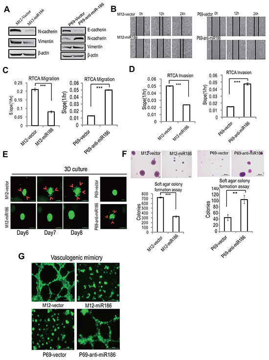 miR186 suppresses PCa cell progression.