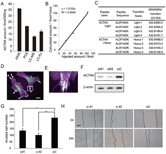 Effect of ACTN4 knockdown using siRNA of ACTN4 on in vitro cell migration ability.