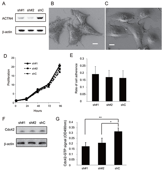 Effect of ACTN4 knockdown using shRNA of ACTN4 on in vitro proliferation, cdc42 activation and adherence to HUVEC.