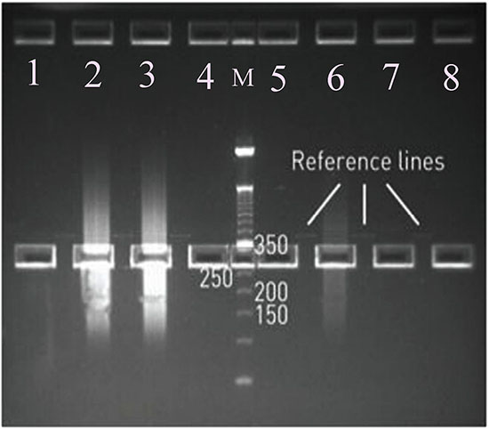 Selections of Mitochondrial Fragment Libraries: The length of sequencing bands: 280-350 bp.