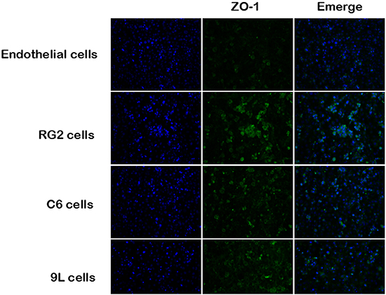 Immunofluoresent localization of ZO-1 in endothelial cell and BTB.