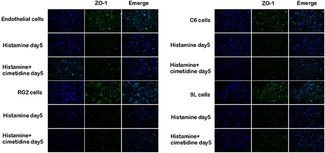Immunofluoresent localization of ZO-1 in endothelial cells and BTB after treatment with histamine and cimetidine.