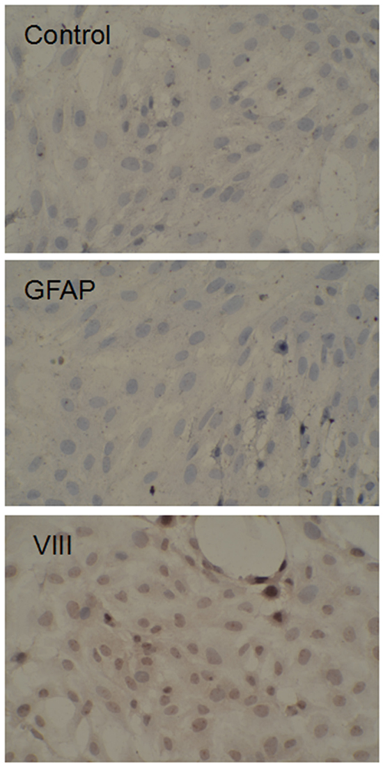 Expression of VIII and GFAP VIII and GFAP expression were detected by immunohistochemical assay immunohistochemical staining of VIII and GFAP in endothelial cell and BTB.