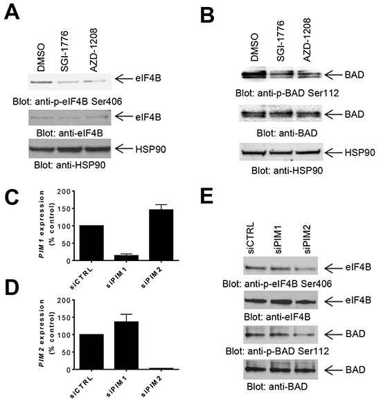 Effects of PIM kinase inhibition on phosphorylation of eIF4B and BAD in GBM cells.