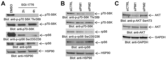 Effects of PIM kinase inhibition on mTORC1 downstream targets in GBM cells.