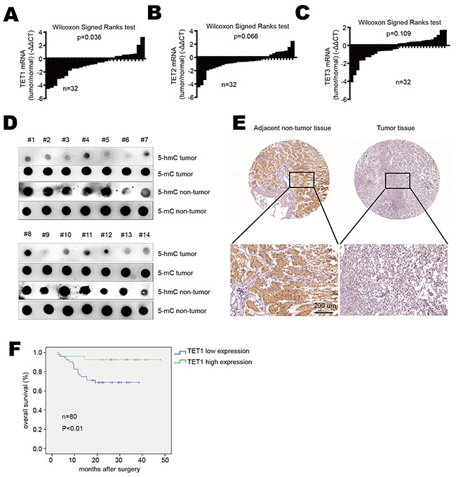 TET1 is down-regulated in gastric cancer.