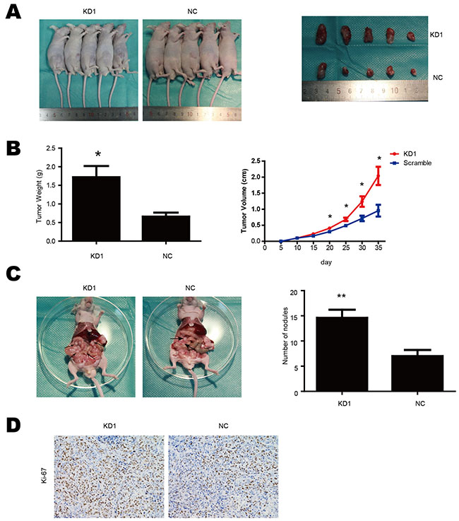 TET1 suppresses gastric cancer cell metastasis and growth in vivo.