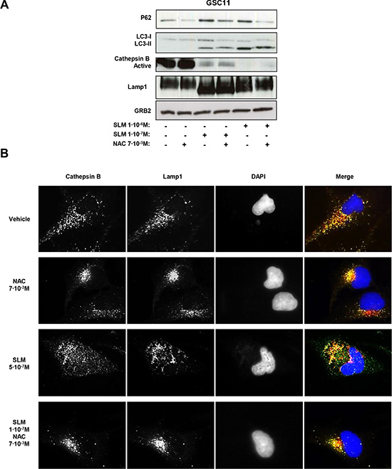 Oxidative stress modulates autophagic flux and lysosomal permeabilization.