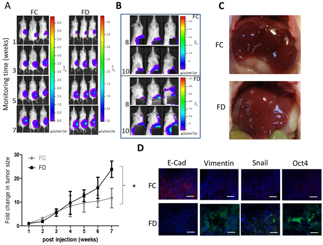 FD condition promoted Sk-Hep1 metastasis in vivo.