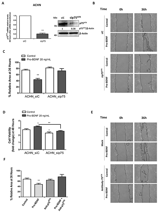 p75NTR RNA silencing or blocking anti-p75NTR antibody inhibits ACHN cell migration.