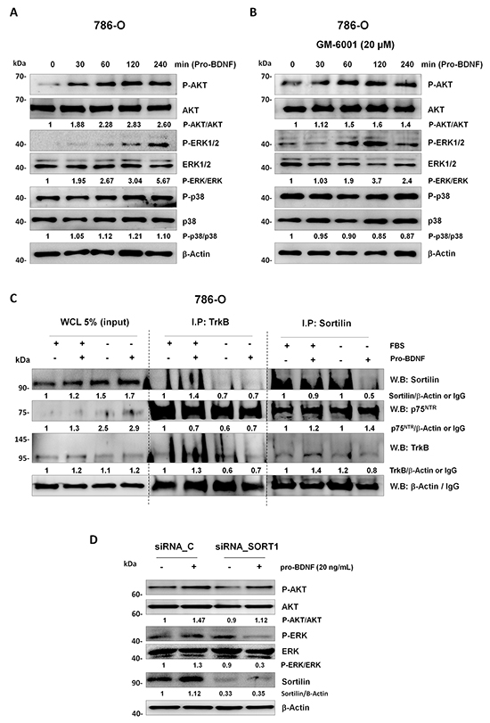 Study of prosurvival signaling pathways and immunoprecipitated receptors complex.