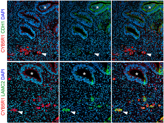 Confocal immune fluorescence for CYB5R1.