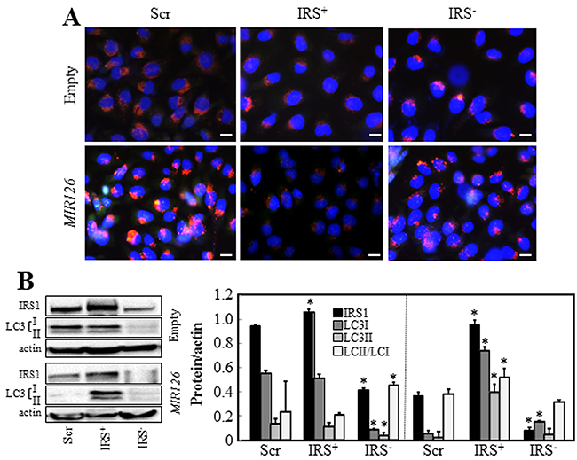 IRS1 is involved in MIR126-induced autophagy.