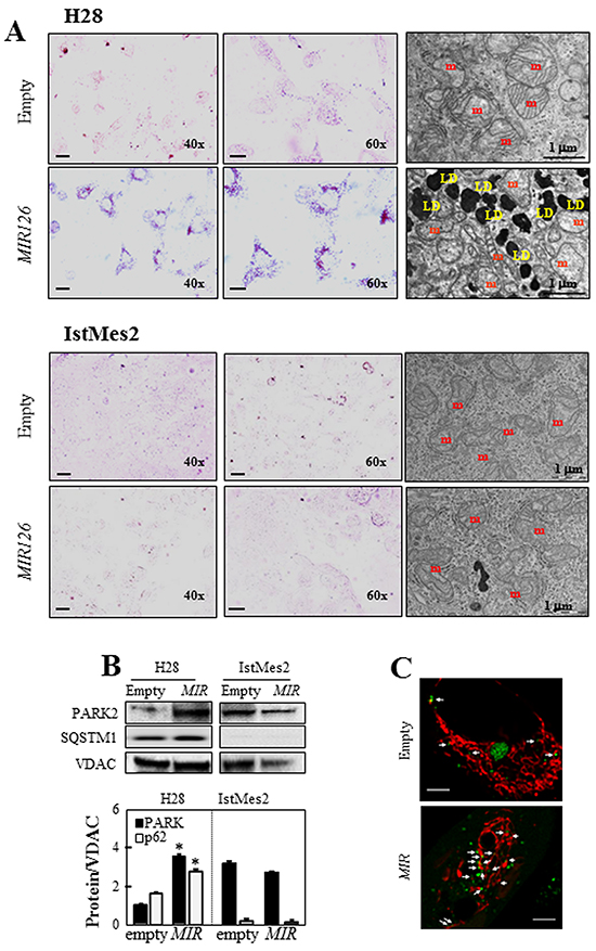 MIR126 overexpression results in lipid accumulation.
