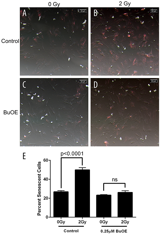 Radiation-induced senescence is reduced in primary colorectal fibroblasts grown in MnTnBuOE-2-PyP.