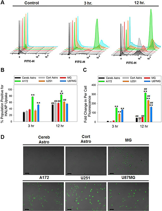 HALNP uptake rate and extent in glioblastoma, astrocytes and microglial cells.