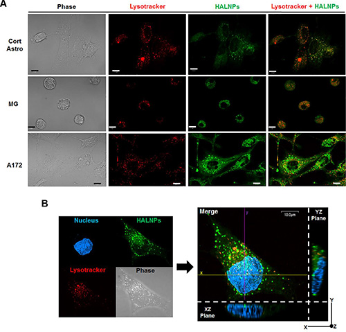 Investigation of HALNP intracellular fate in healthy glial versus GBM cells.