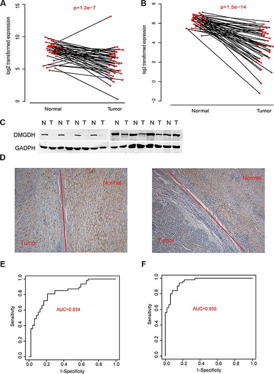 DMGDH expression level is associated with both carcinogenesis.