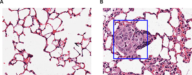 The lung histological section of mice injected with GFP/DMGDH+GFP over expression cell line.