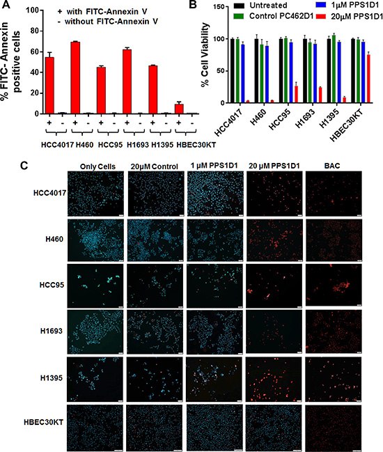 PPS1D1 binding and activity evaluation on panel of lung cancer cells.