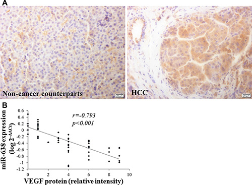 Inverse correlation between miR-638 and VEGF expression in HCC tissues.