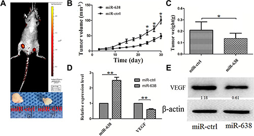 miR-638 inhibits HCC progression in vivo.