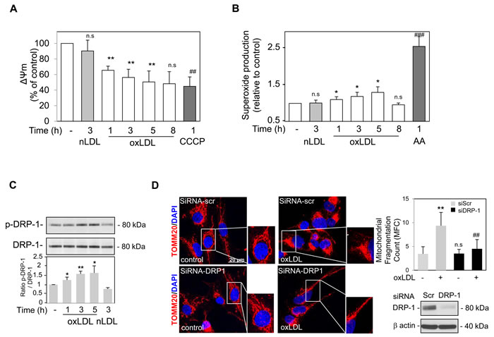 Oxidized LDL induced mitochondrial depolarization, dysfunction and Drp-1 dependent fission in human VSMC.