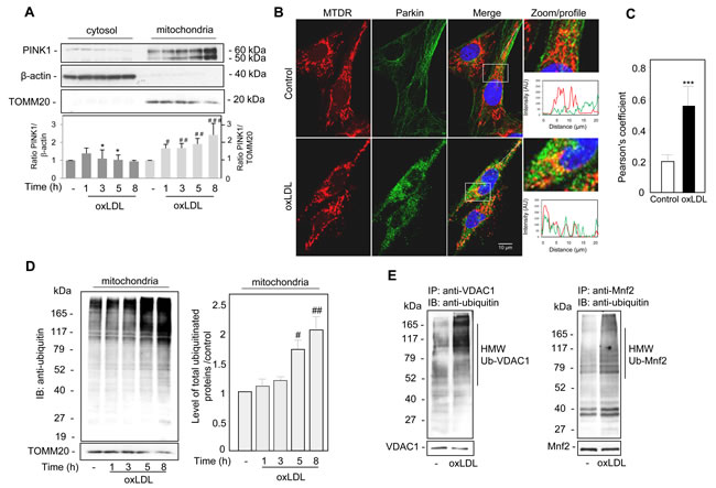 Oxidized LDL induced the recruitment of PINK1 and Parkin to the damaged mitochondria and increased mitochondrial ubiquitinylated proteins in human VSMC.