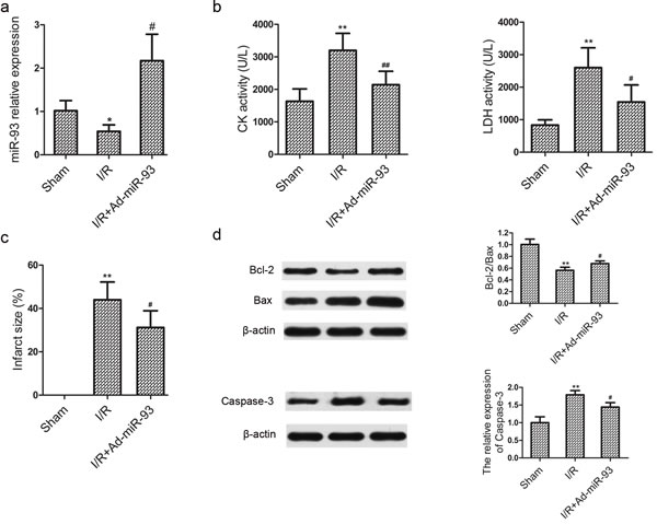 miR-93 protects against myocardial I/R injury