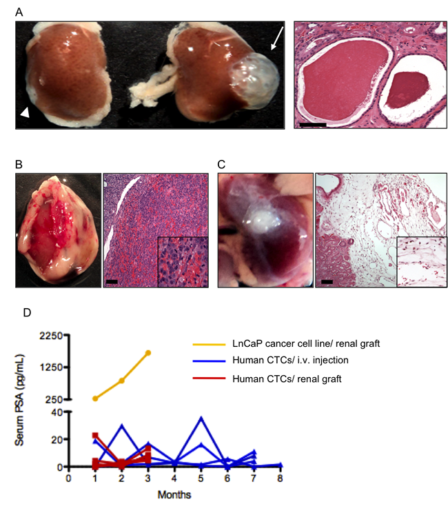 Renal grafts.