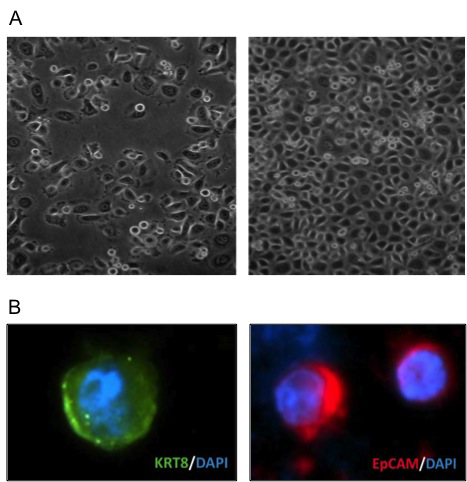 Isolation of tumor cells.