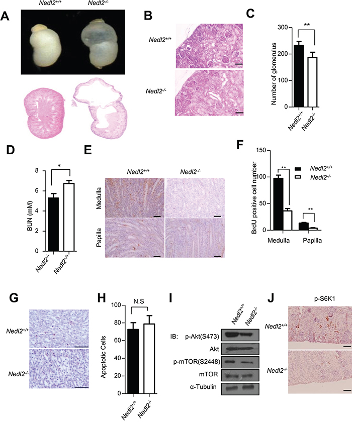 Kidney development defects in Nedl2-/- mice.