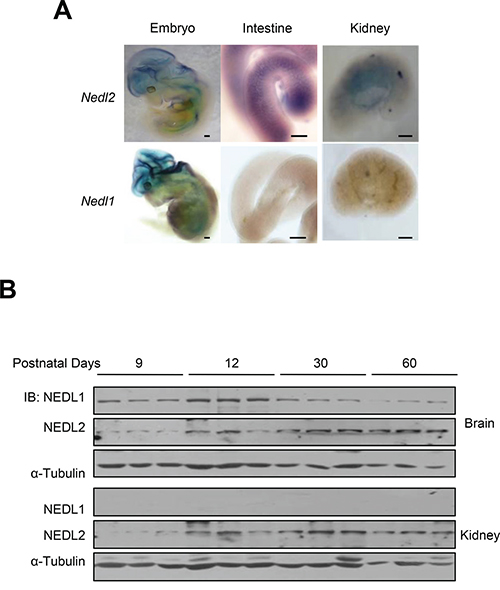 Different expression patterns of NEDL1 and NEDL2.