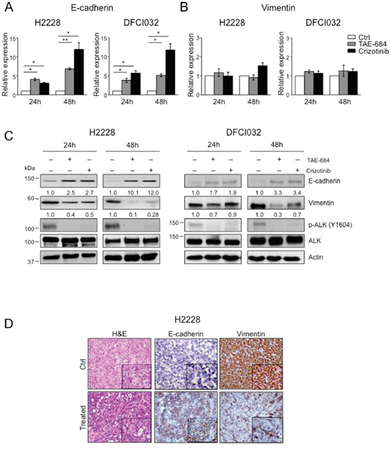 ALK oncogenic activity sustains the mesenchymal phenotype in ALK-rearranged NSCLC.