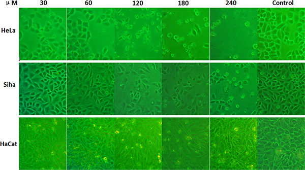 Effects of inhibitor No. 16 on cell growth morphology.