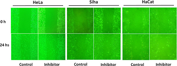 The effect of inhibitor No. 16 on cell migration ability.
