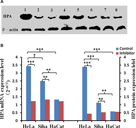 The effect of inhibitor No. 16 on HPA mRNA and protein levels in cervical cancer cells.