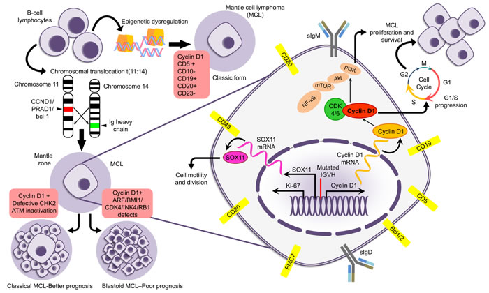 Figure describing the pathological and immunological details of MCL.