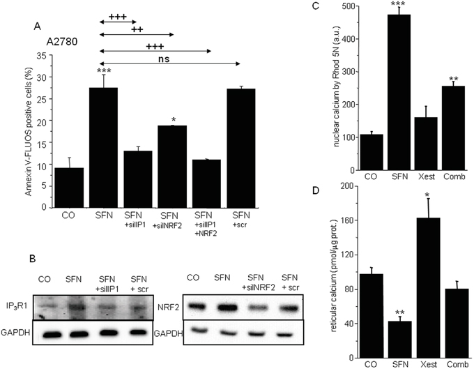 Apoptosis determination in samples with silenced either IP3R1 or NRF2, and combination of both (A) clearly revealed that both these proteins are responsible for the SFN-induced apoptosis.