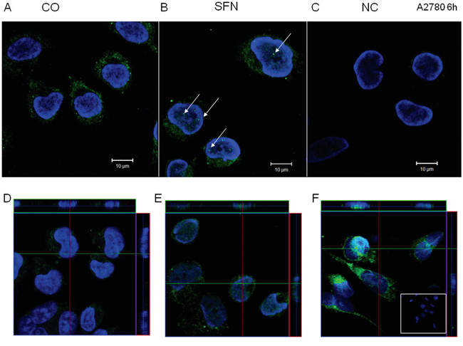 IP3R1 immunofluorescence of control (A, D) and SFN-treated (B, E) A2780 cells.